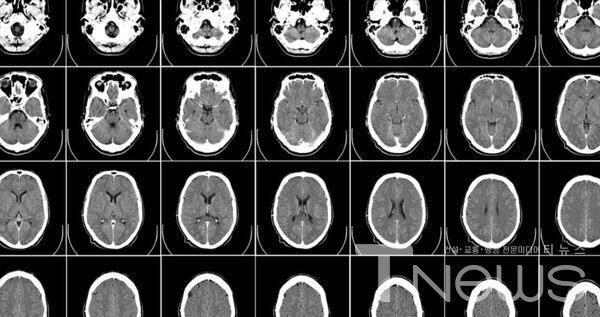 엔비디아 슈퍼컴퓨터로 10만 합성 뇌 이미지 생성 치매, 노화, 뇌 질환 연구 가속화 사진제공 | NVIDIA